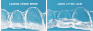 Invisible Clear Teeth Aligners With Spark